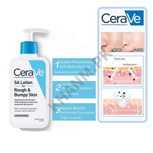 CeraVe SA Lotion for rough and bumpy skin with packaging and before-and-after diagram.